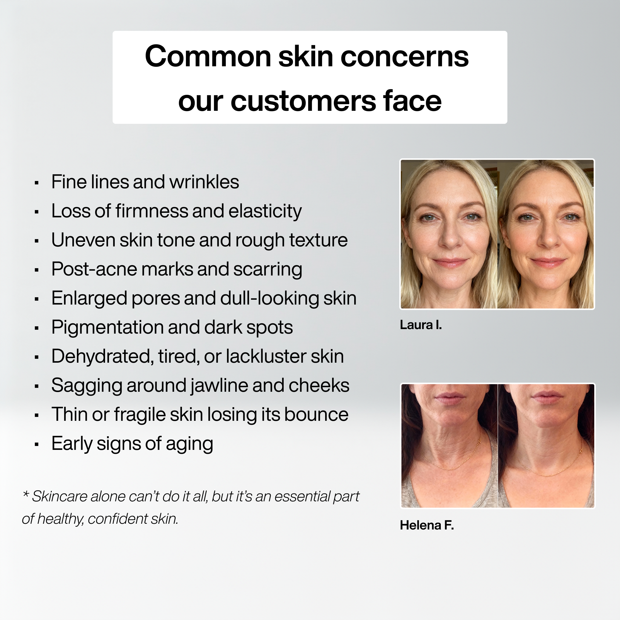 Micro Infusion Set™