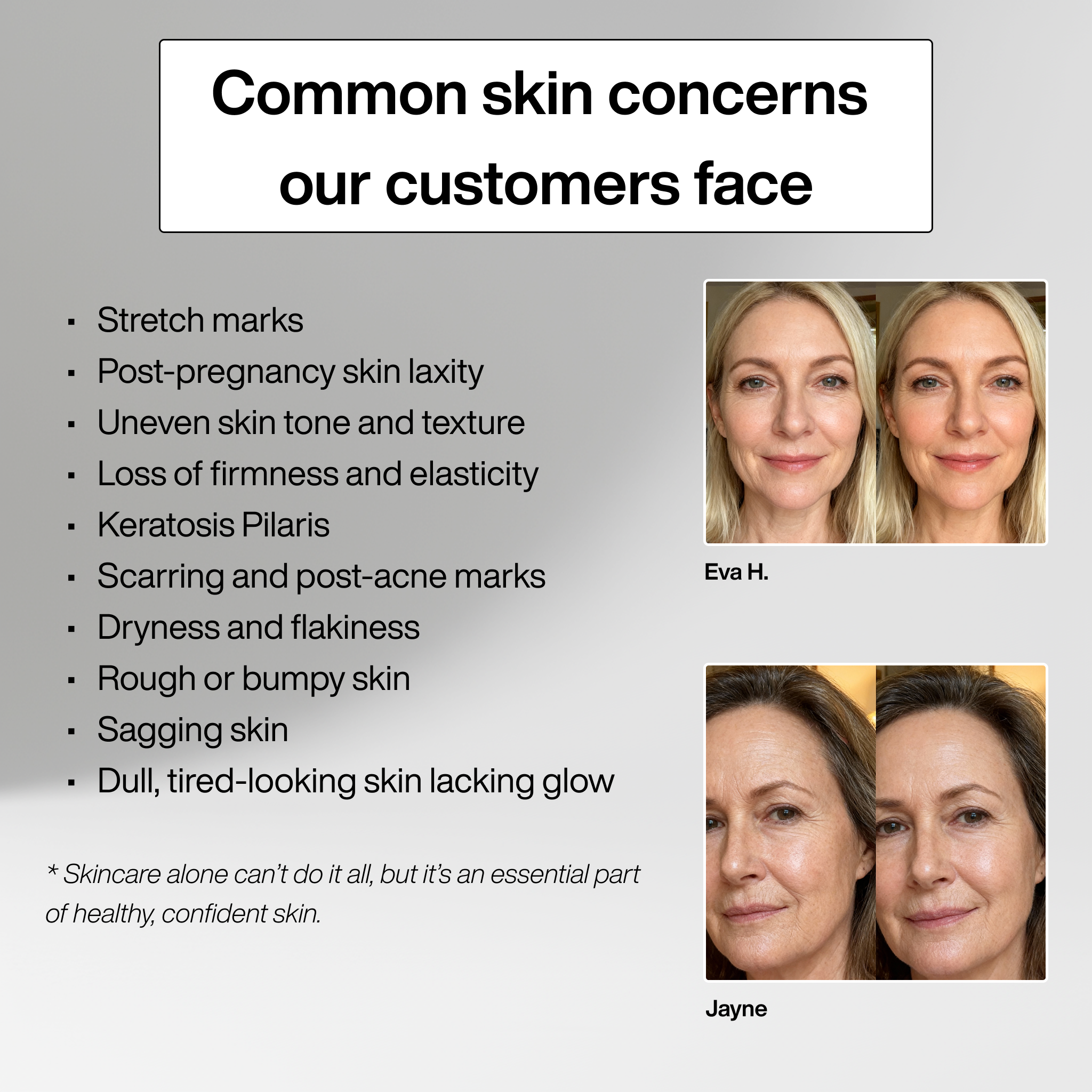 Skin Confidence Set™