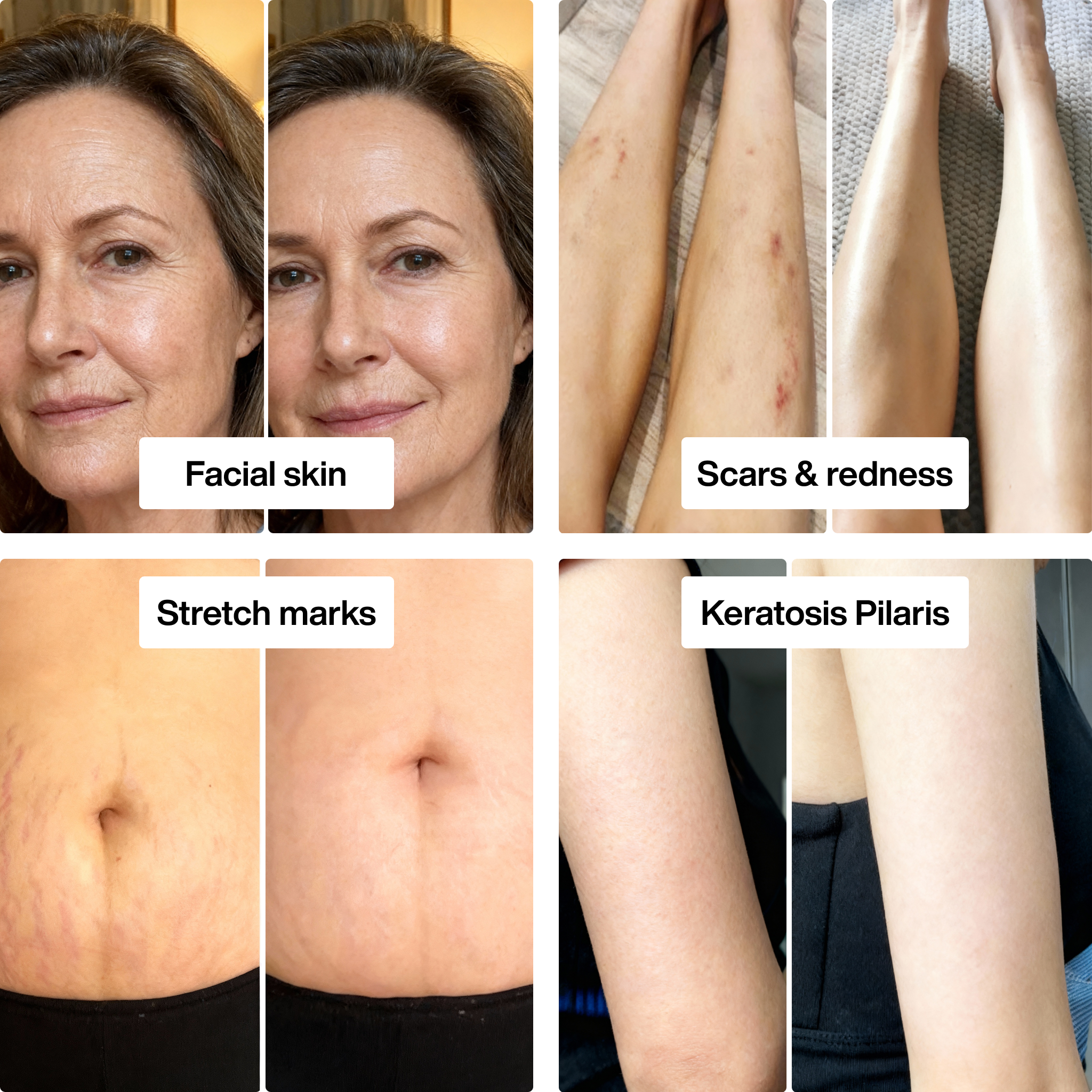 Skin Confidence Set™